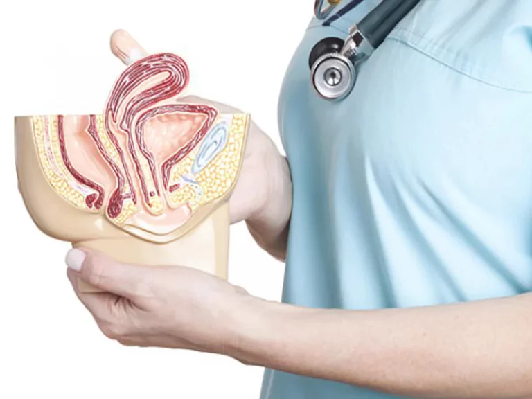 مهم ترین نکاتی که بعد از تنگ کردن واژن باید رعایت شود؟